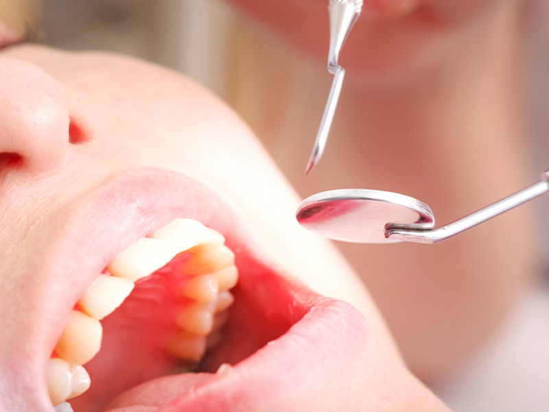 歯科健診を定期的に受けよう!